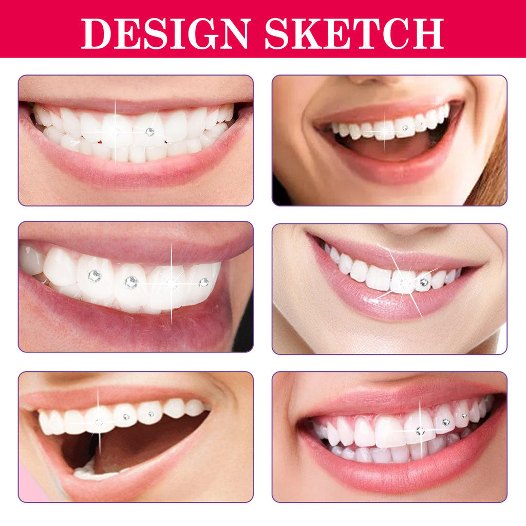 Tooth Gem Kit - Complete Teeth Gems Kit For DIY Tooth Decoration With Glue, Light, And Assorted Gems Perfect For Personalizing Your Smile, Tooth Art, And Cosmetic Teeth Enhancements